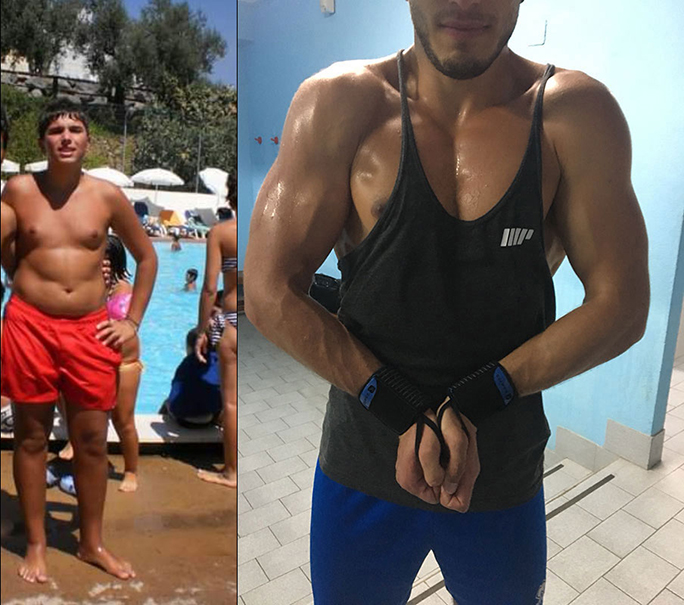 BMI Emanuele prima e dopo
